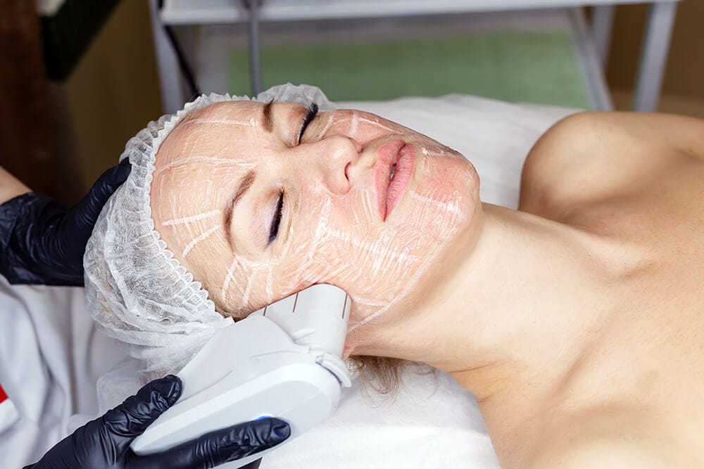 Tratamiento facial HIFU para patas de gallo en LaserPro Valencia