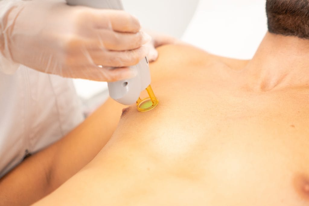 Laser hombre LaserPro Valencia